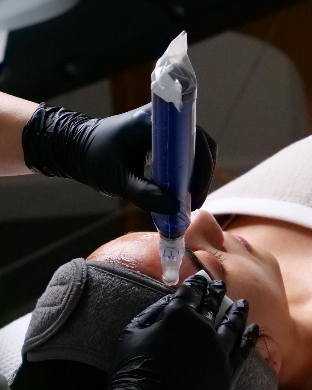 SkinPen Precision Elite Microneedling