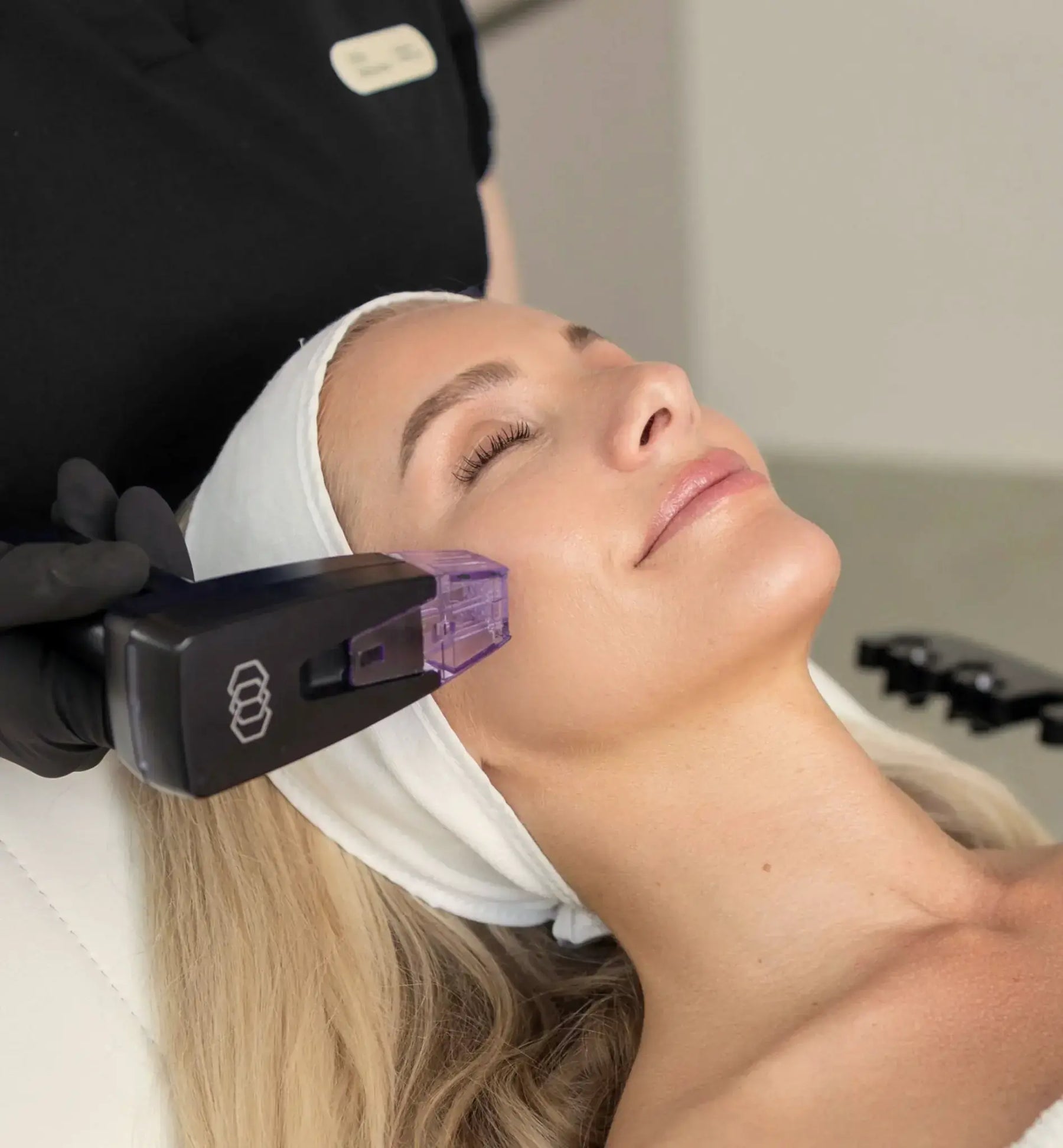 Morpheus8 Facial im Vital Center