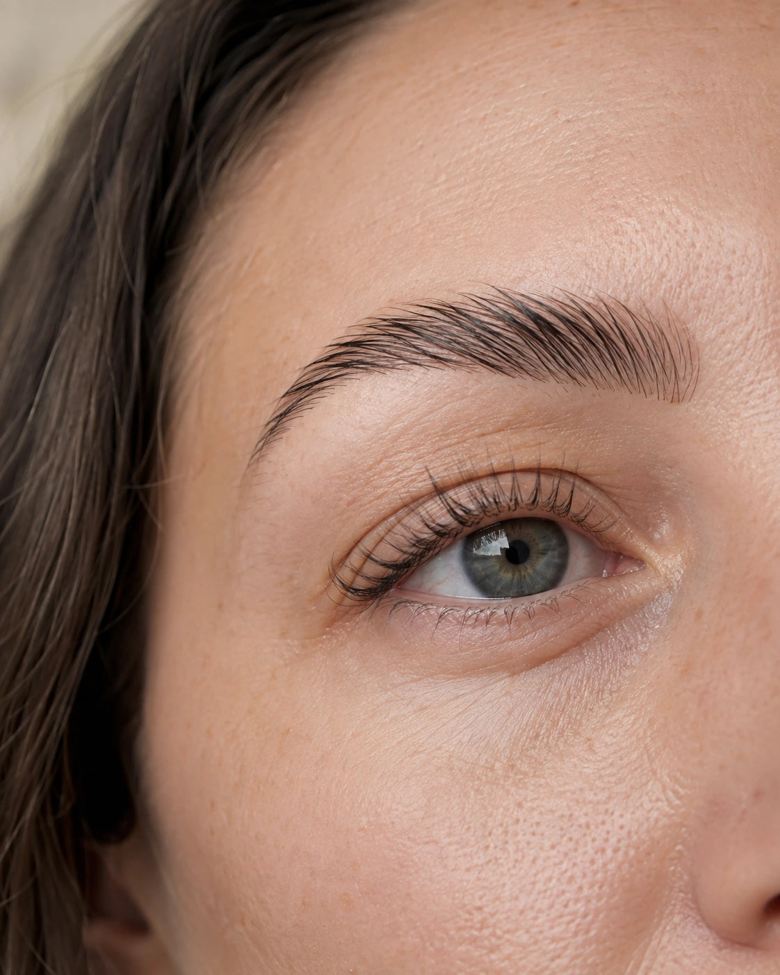 Browlift im Vital Center St. Martin