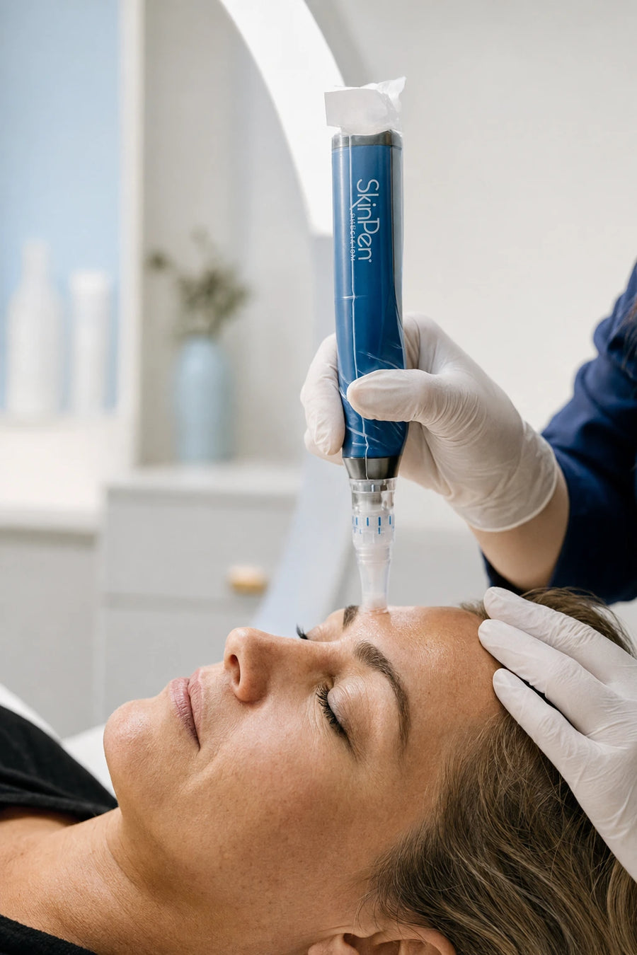Microneedling